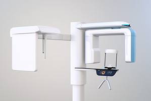 an example of a 3D cone beam imaging scanner