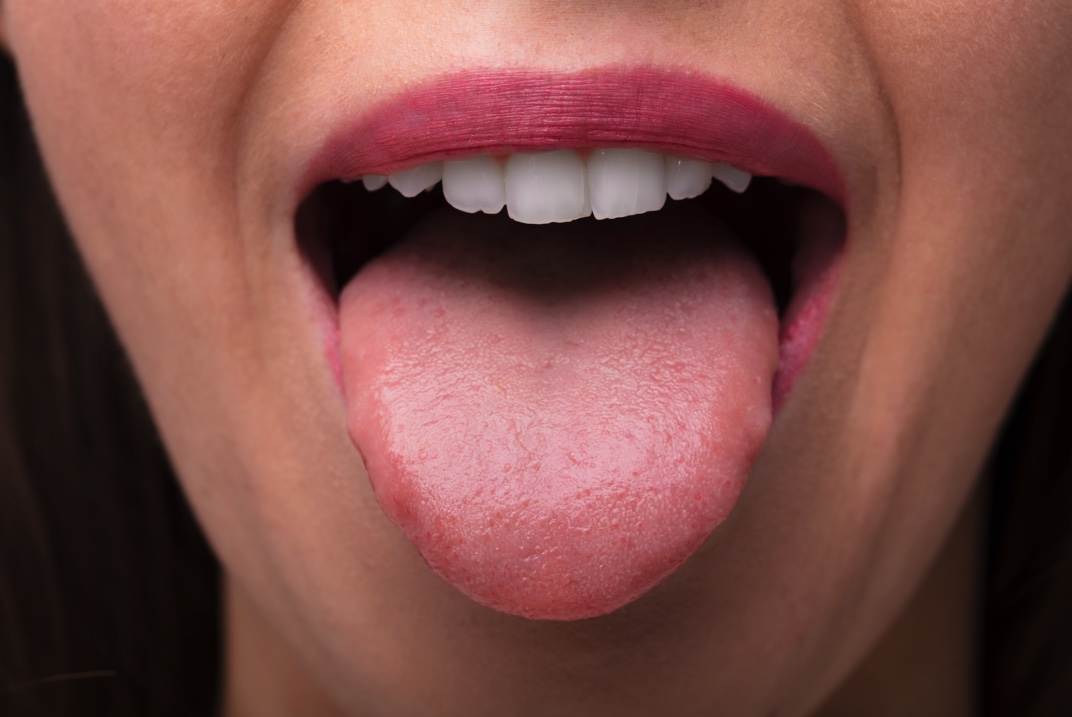 swollen taste buds side of tongue